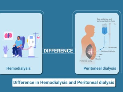 Difference Between Hemodialysis and Peritoneal Dialysis