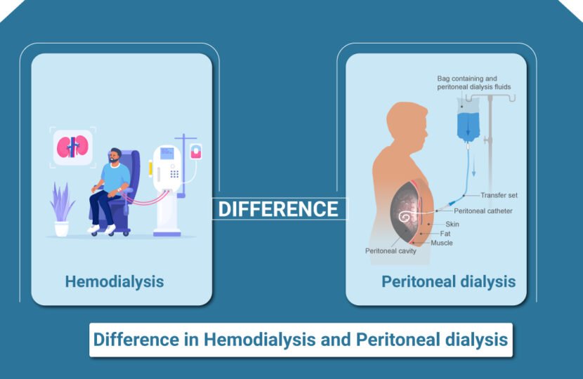 Difference between Hemodialysis and Peritoneal Dialysis