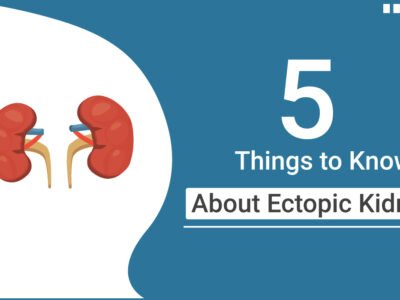 5 Things to Know About Ectopic Kidney