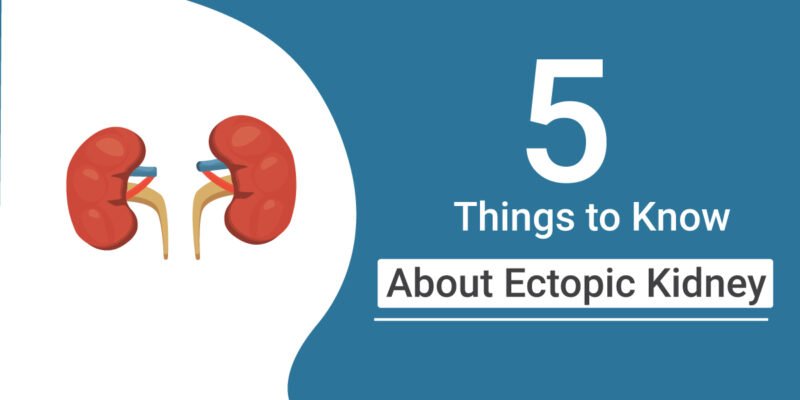 ectopic kidney
