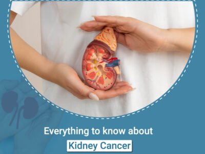Everything to know about Kidney Cancer