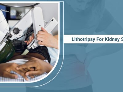 Lithotripsy For Kidney Stones