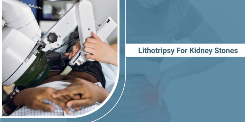 Lithotripsy For Kidney Stones