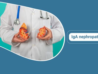 IgA Nephropathy overview