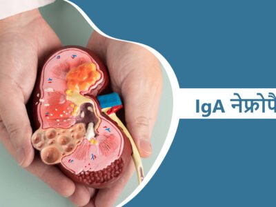IgA नेफ्रोपैथी – IgA Nephropathy in Hindi