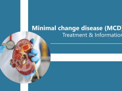 Minimal change disease (MCD) Treatment & Information