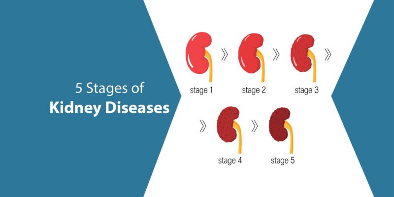 5 Stages of Kidney Diseases