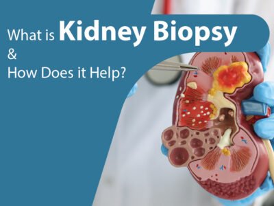 What is Kidney Biopsy and How Does it Help?