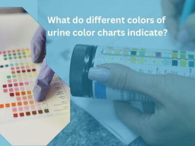 What do different colors of urine color charts indicate?