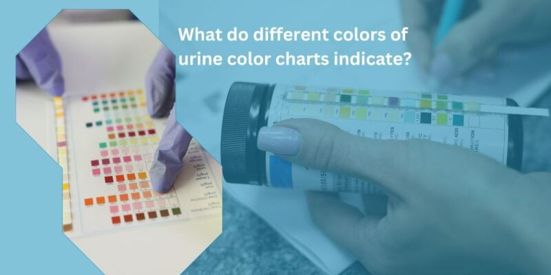 What do different colors of urine color charts indicate