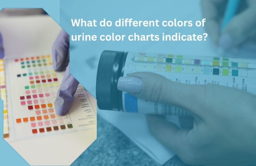 What do different colors of urine color charts indicate