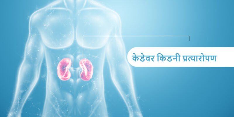 cadaver-kidney-transplant-in-hindi