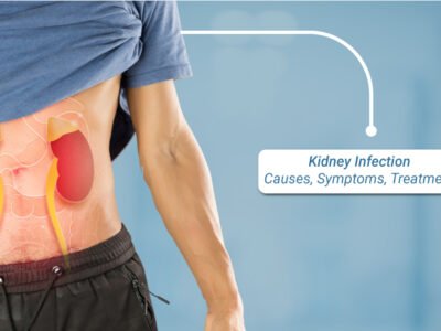 Kidney Infection – Causes, Symptoms, Treatment