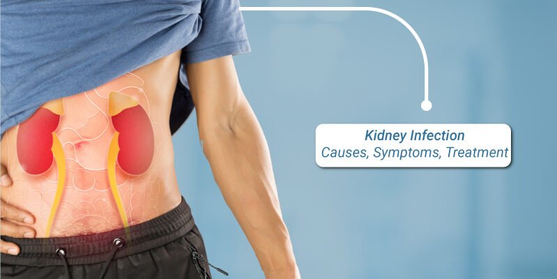 Kidney-infection-causes-symptoms-treatment