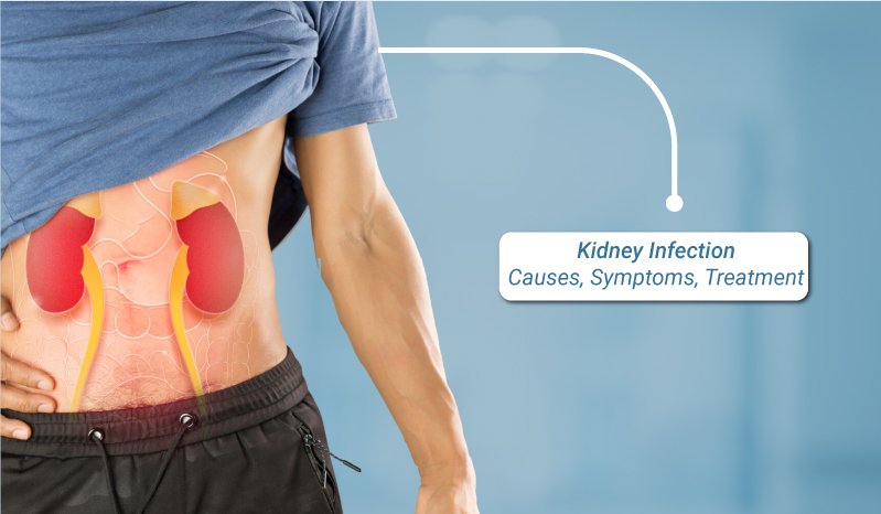 Kidney-infection-causes-symptoms-treatment