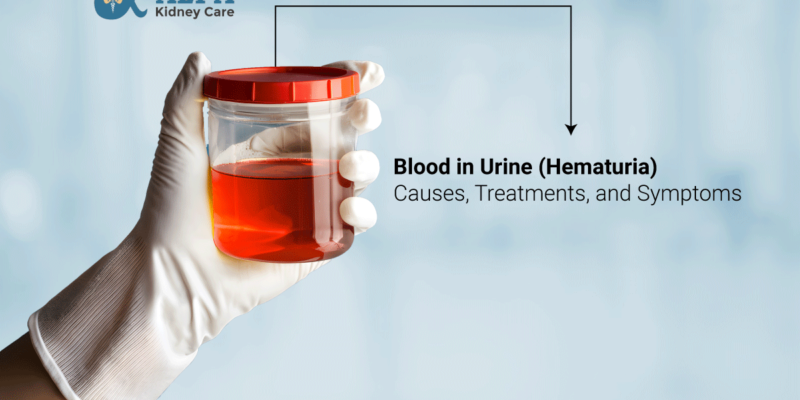 Blood-in-Urine-Hematuria-Causes-Treatments-Symptoms