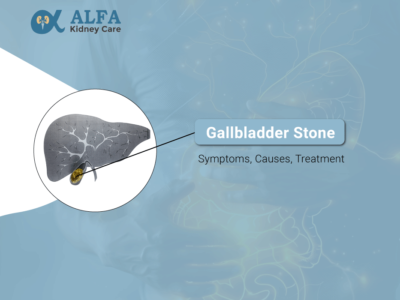 Gallbladder Stone? Symptoms, Causes, Treatment