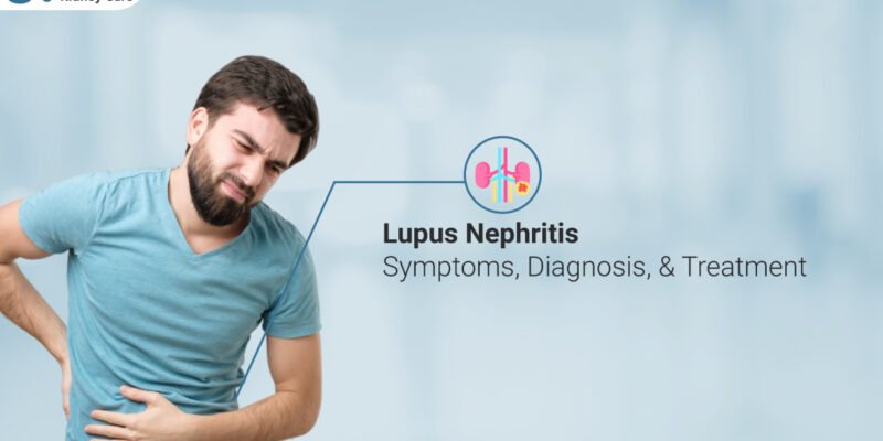 Lupus Nephritis Symptoms Diagnosis Treatment