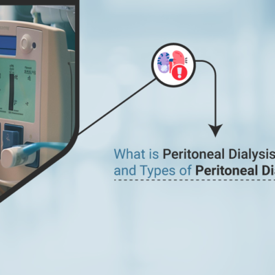 Arteriovenous Fistula Creation for Dialysis Access | Alfa Kidney Care