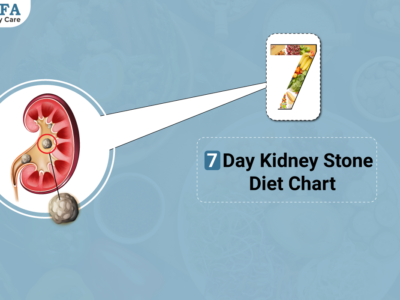 7-Day Kidney Stone Diet Chart: A Comprehensive Guide
