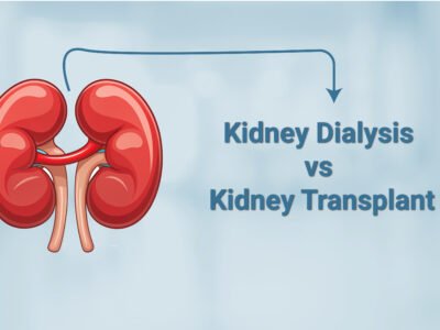 Kidney Dialysis vs. Kidney Transplant