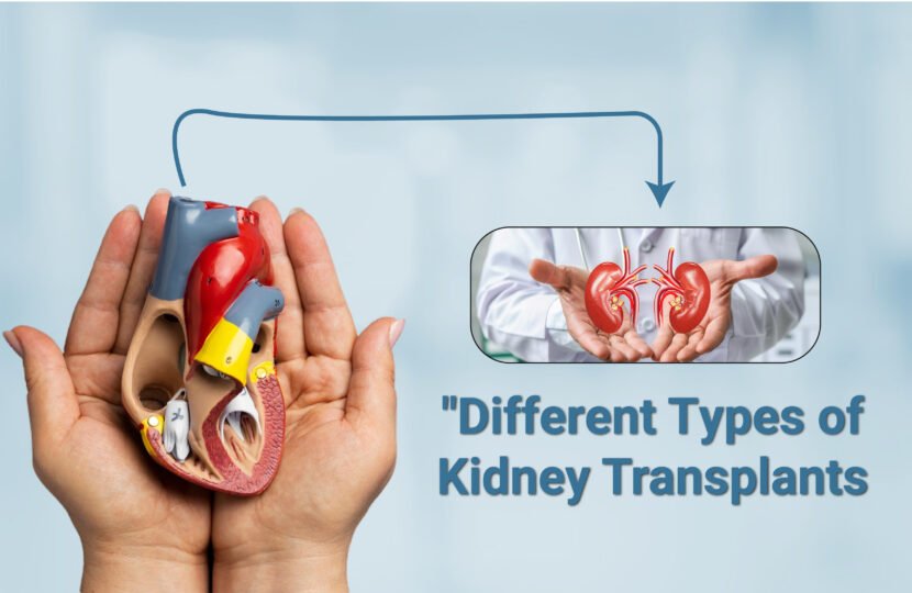 Types of Kidney Transplants