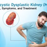 Multicystic Dysplastic Kidney (MCDK)