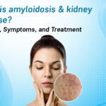 What-is-amyloidosis-and-kidney-disease