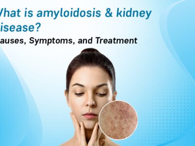 What is amyloidosis & kidney disease? Causes, Symptoms, Treatment