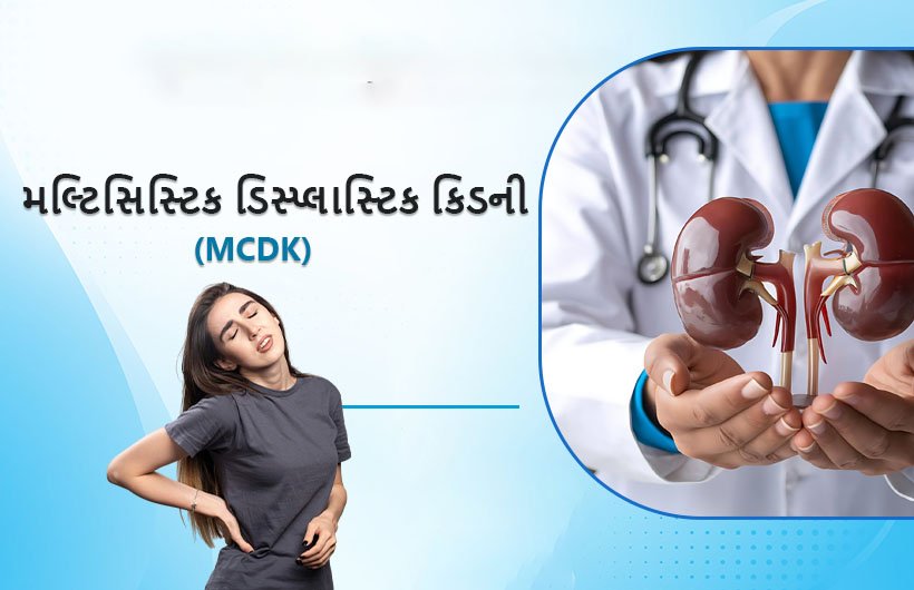 Multicystic Dysplastic Kidney in Gujarati1