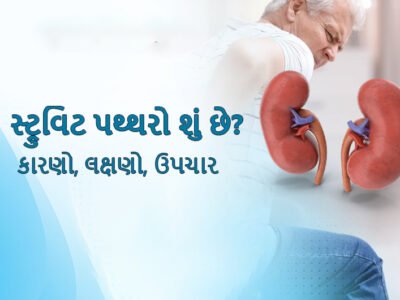 સ્ટ્રુવિટ પથ્થરો શું છે? કારણો, લક્ષણો, ઉપચાર