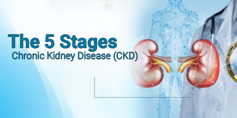 Stages of Chronic Kidney Disease