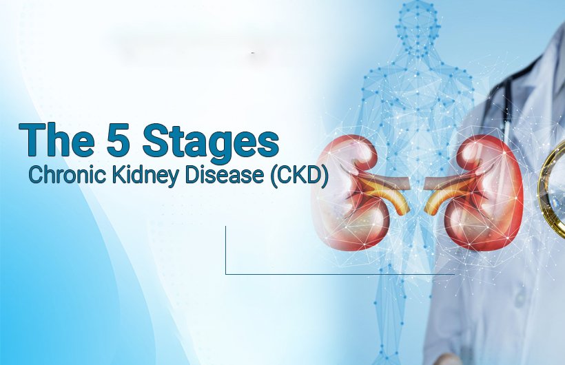 Stages of Chronic Kidney Disease