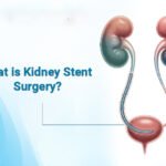What is Kidney Stent Surgery