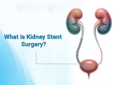 What is Kidney Stent Surgery?