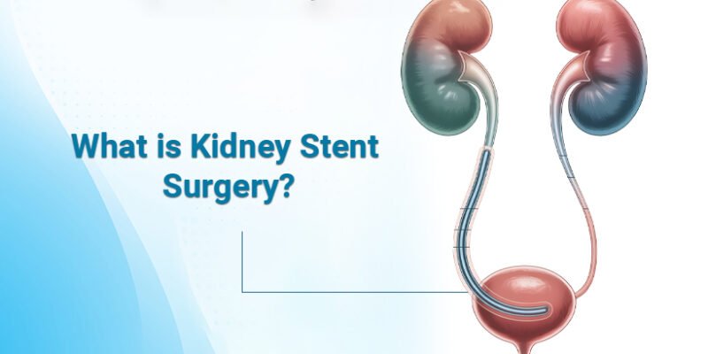 What is Kidney Stent Surgery