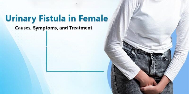Urinary Fistula in Female