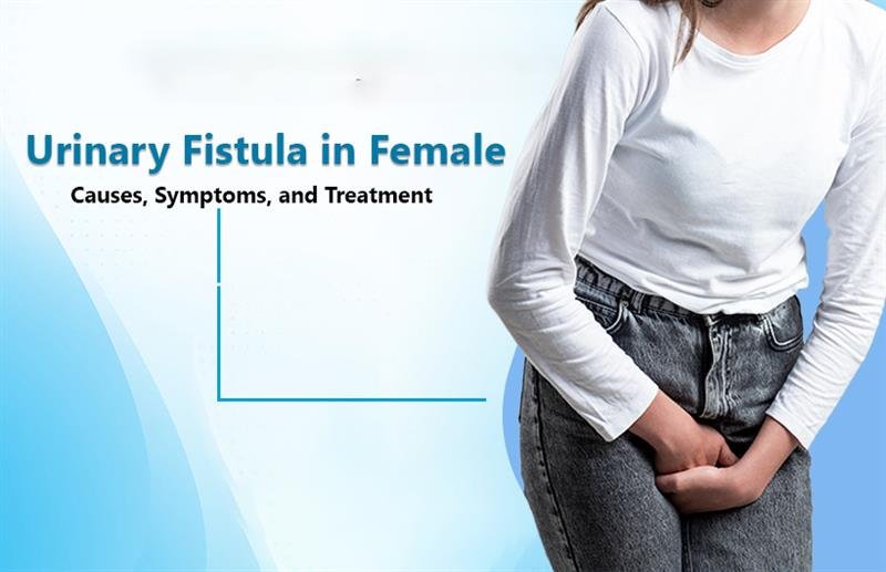 Urinary Fistula in Female