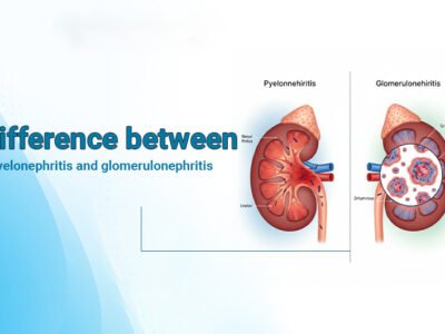 Difference between Pyelonephritis and Glomerulonephritis