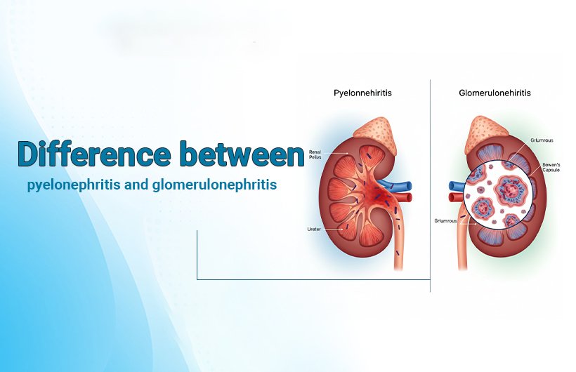 Difference between pyelonephritis and glomerulonephriti