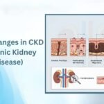 Skin changes in CKD
