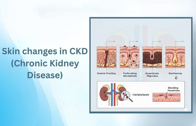 Skin changes in CKD