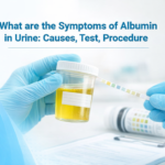 What are the Symptoms of Albumin in Urine