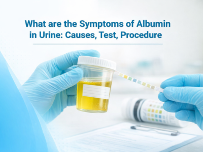 What are the Symptoms of Albumin in Urine: Causes, Test, Procedure