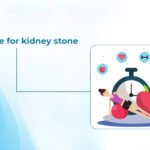 Exercise for kidney stone