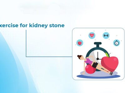 Exercise for kidney stone