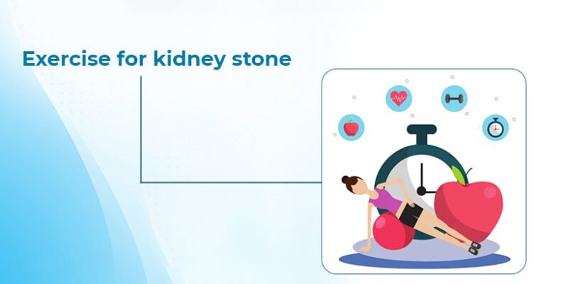 Exercise for kidney stone