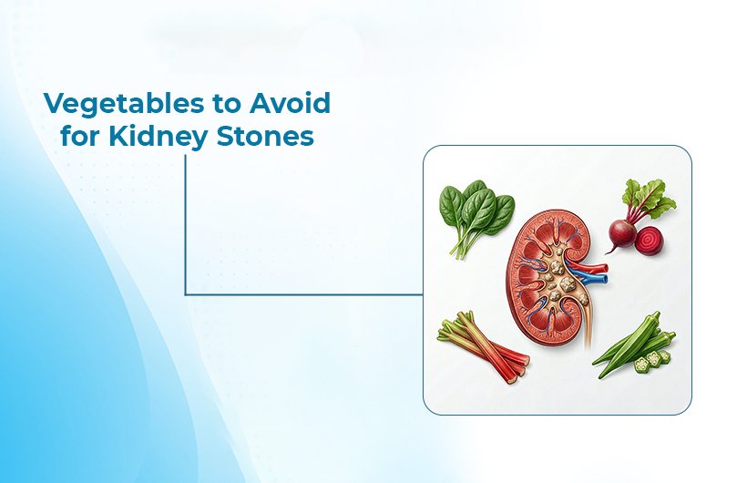 Vegetables to Avoid for Kidney Stones