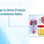 What is Urine Protein Creatinine Ratio