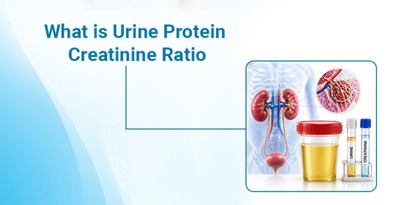 What is Urine Protein Creatinine Ratio